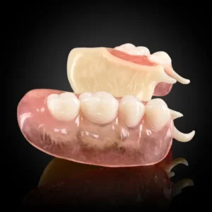 Acetal Framework Partial Denture