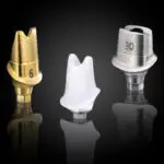 Dental Implant