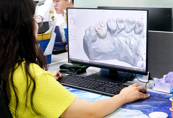CAD/CAM Technology in Dental Laboratories: Past, Present, and Future