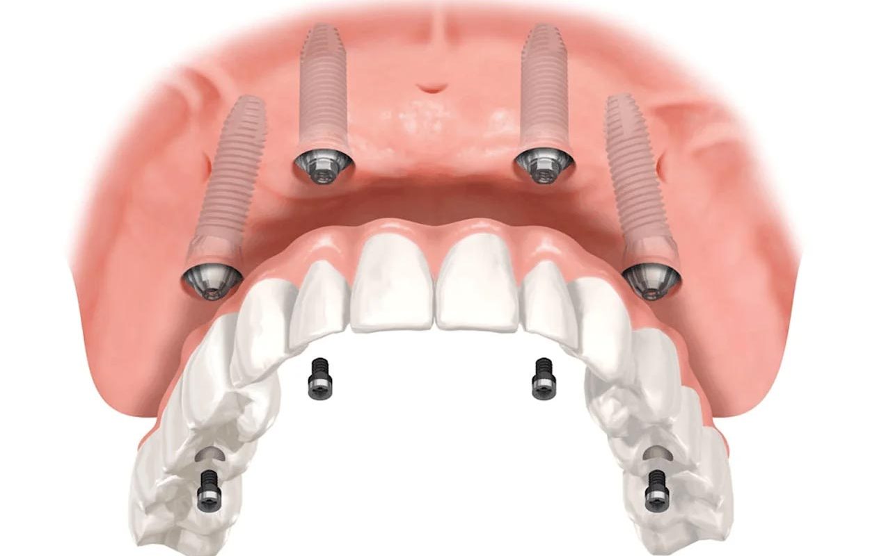 csmile73